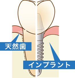 サンプル